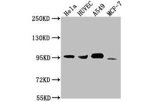 Western Blot Positive WB detected in: Hela whole cell lysate, HUVEC whole cell lysate, A549 whole cell lysate, MCF-7 whole cell lysate All lanes: CD44 antibody at 1:1500 Secondary Goat polyclonal to Mouse IgG at 1/10000 dilution Predicted band size: 82, 4, 78, 77, 81, 79, 75, 54,47, 40, 44, 33, 74, 76, 38, 16 kDa Observed band size: 95 kDa (CD44 Antikörper  (AA 21-220))
