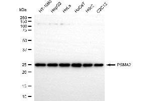 anti-Proteasome Subunit alpha 2 (PSMA2) antibody