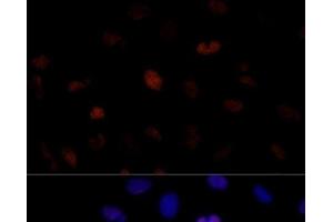 Immunofluorescence analysis of U-2 OS cells using PSME3 Polyclonal Antibody at dilution of 1:100 (40x lens). (PSME3 Antikörper)