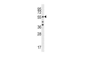 Cdc25A Antibody (S78) (ABIN390215 and ABIN2840697) western blot analysis in MCF-7 cell line lysates (35 μg/lane). (CDC25A Antikörper  (AA 57-84))