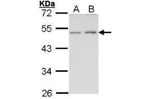 Western Blotting (WB) image for anti-Endothelin Receptor Type B (EDNRB) (N-Term) antibody (ABIN2854727)
