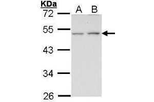 WB Image Sample (30 ug of whole cell lysate) A: A431 , B: H1299 10% SDS PAGE antibody diluted at 1:1000 (EDNRB Antikörper  (N-Term))