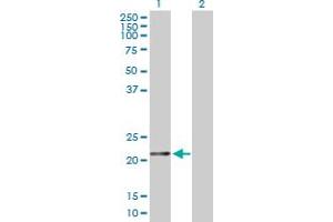 Western Blot analysis of FTH1 expression in transfected 293T cell line by FTH1 MaxPab polyclonal antibody. (FTH1 Antikörper  (AA 1-183))