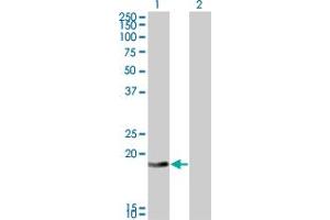 Western Blot analysis of DCTD expression in transfected 293T cell line by DCTD monoclonal antibody (M01), clone 4B9. (DCMP Deaminase (DCTD) (AA 69-178) Antikörper)