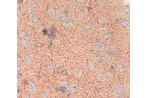 IHC-P analysis of Rat Tissue, with DAB staining. (DSTYK Antikörper  (AA 650-904))