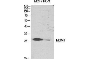 Western Blot (WB) analysis of specific cells using MGMT Polyclonal Antibody. (MGMT Antikörper  (N-Term))