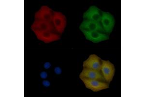 PIKFYVE Mouse Monoclonal Antibody staining Hela cells by IF/ICC. (PIKFYVE Antikörper)