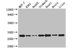 Western Blot Positive WB detected in: MCF-7 whole cell lysate, K562 whole cell lysate, HepG2 whole cell lysate, Mouse stomach tissue, Mouse heart tissue, Mouse brain tissue, Mouse liver tissue All lanes: RABGAP1L antibody at 3 μg/mL Secondary Goat polyclonal to rabbit IgG at 1/50000 dilution Predicted band size: 30, 93, 69, 95, 91, 44, 42, 43, 9 kDa Observed band size: 30 kDa (RABGAP1L Antikörper  (Isoform 10))