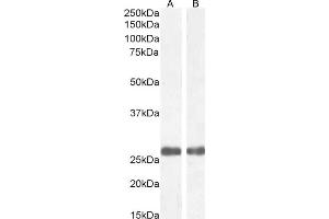 (ABIN185321) (1 μg/mL) staining of Human Heart (A) and Liver (B) lysate (35 μg protein in RIPA buffer). (MBL2 Antikörper  (C-Term))