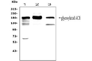 Western blot analysis of ACE using anti-ACE antibody (ABIN3043777).