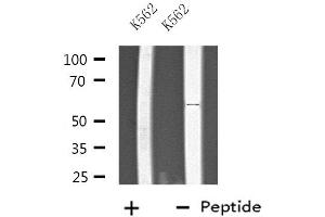 Western blot analysis of extracts from K562 cells, using PTGIS antibody. (PTGIS Antikörper  (Internal Region))