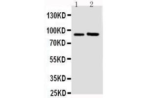 Anti-FGFR3 antibody, Western blotting Lane 1: U87 Cell Lysate Lane 2: SGC Cell Lysate (FGFR3 Antikörper  (N-Term))