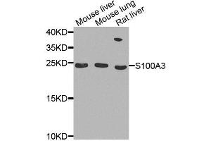 Western blot analysis of extracts of various cell lines, using S100A3 antibody. (S100A3 Antikörper  (AA 1-101))