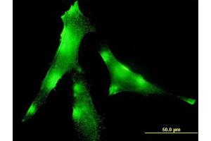 Immunofluorescence of monoclonal antibody to EVL on HeLa cell.