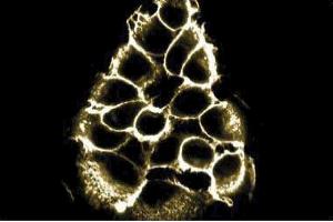 Immunofluorescent staining of A431 cell line with beta-Catenin antibody. (beta Catenin Antikörper  (AA 571-781))