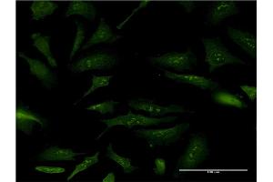 Immunofluorescence of monoclonal antibody to NPM2 on HeLa cell. (NPM2 Antikörper  (AA 1-214))