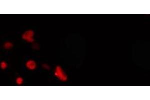 ABIN6274269 staining COLO205 cells by IF/ICC. (MEOX2 Antikörper  (Internal Region))