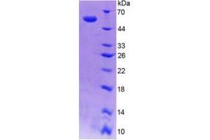 SDS-PAGE (SDS) image for Sepiapterin Reductase (SPR) (AA 1-261) protein (His tag,GST tag) (ABIN6237200) (SPR Protein (AA 1-261) (His tag,GST tag))