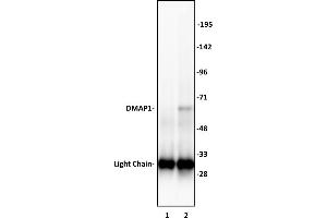 DMAP1 antibody (pAb) tested by Immunoprecipitation. (DMAP1 Antikörper  (C-Term))