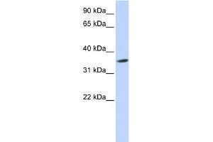 WB Suggested Anti-SEPT12 Antibody Titration: 0. (Septin 12 Antikörper  (Middle Region))