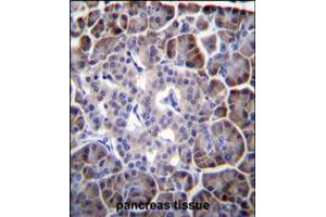 MYBPHL Antibody immunohistochemistry analysis in formalin fixed and paraffin embedded human pancreas tissue followed by peroxidase conjugation of the secondary antibody and DAB staining. (MYBPHL Antikörper  (N-Term))