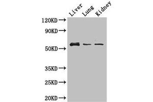 Western Blot Positive WB detected in: Mouse liver tissue, Mouse lung tissue, Mouse kidney tissue All lanes: MMP8 antibody at 3 μg/mL Secondary Goat polyclonal to rabbit IgG at 1/50000 dilution Predicted band size: 54 kDa Observed band size: 54 kDa (MMP8 Antikörper  (AA 22-283))