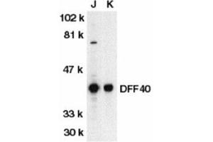 Western blot analysis of DFF40 in Jurkat (J) and K562 (K) whole cell lysate with AP30287PU-N DFF40 antibody at 1/500 dilution.