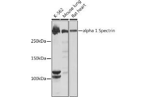 Western blot analysis of extracts of various cell lines, using alpha 1 Spectrin Rabbit mAb (ABIN7270517) at 1:1000 dilution. (SPTA1 Antikörper)