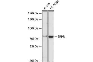 Western blot analysis of extracts of various cell lines, using SRPR antibody (ABIN6130704, ABIN6148457, ABIN6148458 and ABIN6221633) at 1:1000 dilution.
