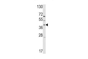 Western blot analysis of hRai3- (ABIN390176 and ABIN2840668) in T47D cell line lysates (35 μg/lane).