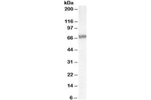 Western blot testing of Jurkat lysate with ABCD4 antibody at 0.