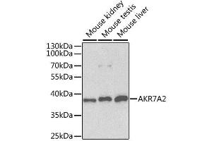 Western blot analysis of extracts of various cell lines, using AKR7A2 antibody. (AKR7A2 Antikörper  (AA 100-359))