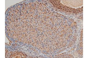 Immunohistochemistry (IHC) image for anti-LIM Domain Kinase 1 (LIMK1) (pThr508) antibody (ABIN6255701)