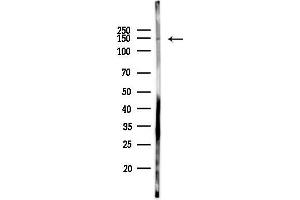 anti-ELKS/RAB6-Interacting/CAST Family Member 1 (ERC1) (N-Term) antibody