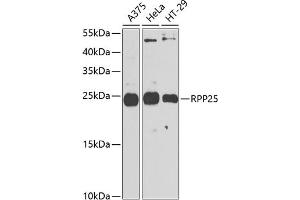 Western blot analysis of extracts of various cell lines, using RPP25 antibody (ABIN6133248, ABIN6147176, ABIN6147177 and ABIN6225317) at 1:1000 dilution. (RPP25 Antikörper  (AA 1-199))