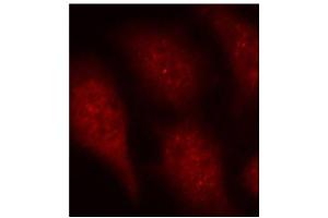 Immunofluorescence staining of methanol-fixed HeLa cells using Phospho-CDK6-Y24 antibody (ABIN2987839). (CDK6 Antikörper  (pTyr24))