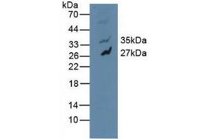 Figure. (MAPK10 Antikörper  (AA 88-332))