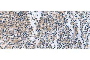 Immunohistochemistry of paraffin-embedded Human tonsil tissue using RGS2 Polyclonal Antibody at dilution of 1:95(x200) (RGS2 Antikörper)