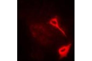 Immunofluorescent analysis of HAS3 staining in A549 cells. (HAS3 Antikörper)