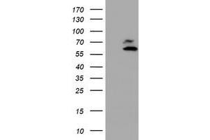 HEK293T cells were transfected with the pCMV6-ENTRY control (Left lane) or pCMV6-ENTRY ARCN1 (Right lane) cDNA for 48 hrs and lysed. (ARCN1 Antikörper)