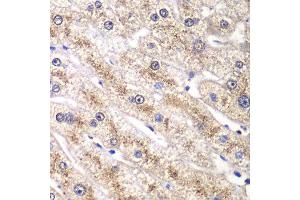 Immunohistochemistry of paraffin-embedded human liver injury using RALB antibody at dilution of 1:100 (x40 lens).