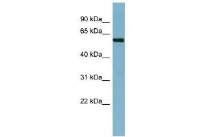 CAP1 antibody used at 1 ug/ml to detect target protein. (CAP1 Antikörper)