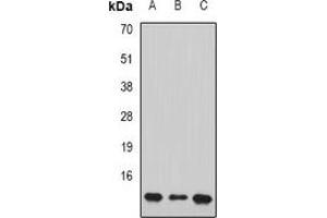 Western blot analysis of PC4 expression in HL60 (A), Jurkat (B), mouse brain (C) whole cell lysates. (SUB1 Antikörper)