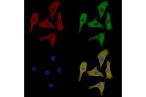 CD79A Mouse Monoclonal Antibody staining Hela cells by IF/ICC.