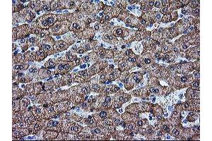 Immunohistochemical staining of paraffin-embedded Human liver tissue using anti-ARG1 mouse monoclonal antibody. (Liver Arginase Antikörper)
