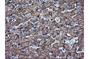 Immunohistochemical staining of paraffin-embedded Human liver tissue using anti-ARG1 mouse monoclonal antibody.