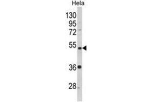 Western blot analysis of PPP2R2B Antibody (Center) in Hela cell line lysates (35ug/lane).