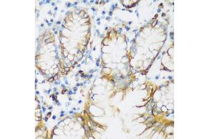 Immunohistochemistry of paraffin-embedded human stomach using CDH1 antibody (ABIN5997408) at dilution of 1/200 (40x lens). (E-cadherin Antikörper)