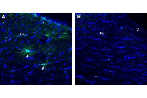 Immunohistochemical staining of perfusion-fixed frozen mouse brain sections using Anti-TMEM108 (extracellular) Antibody (ABIN7885615), (1:300), followed by goat anti-rabbit-. (TMEM108 Antikörper  (Extracellular Loop))