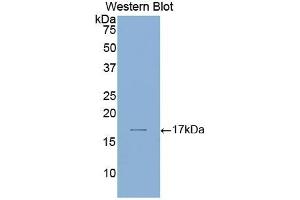 Detection of Recombinant LAMa1, Human using Polyclonal Antibody to Laminin Alpha 1 (LAMA1) (Laminin alpha 1 Antikörper  (AA 2613-2746))